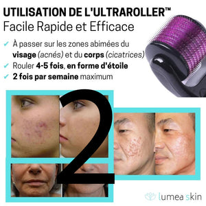 UltraRoller™ - Acné, Rides, Cicatrices